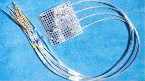 First "Plug and Play" Brain Prosthesis Helps Paralysis Patient