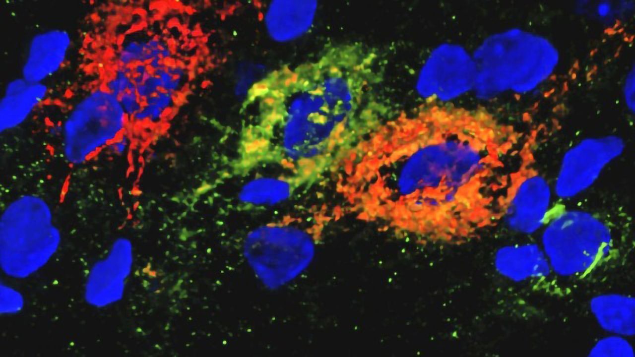Rodent Diabetes Sent Into Remission by Single Protein Injection