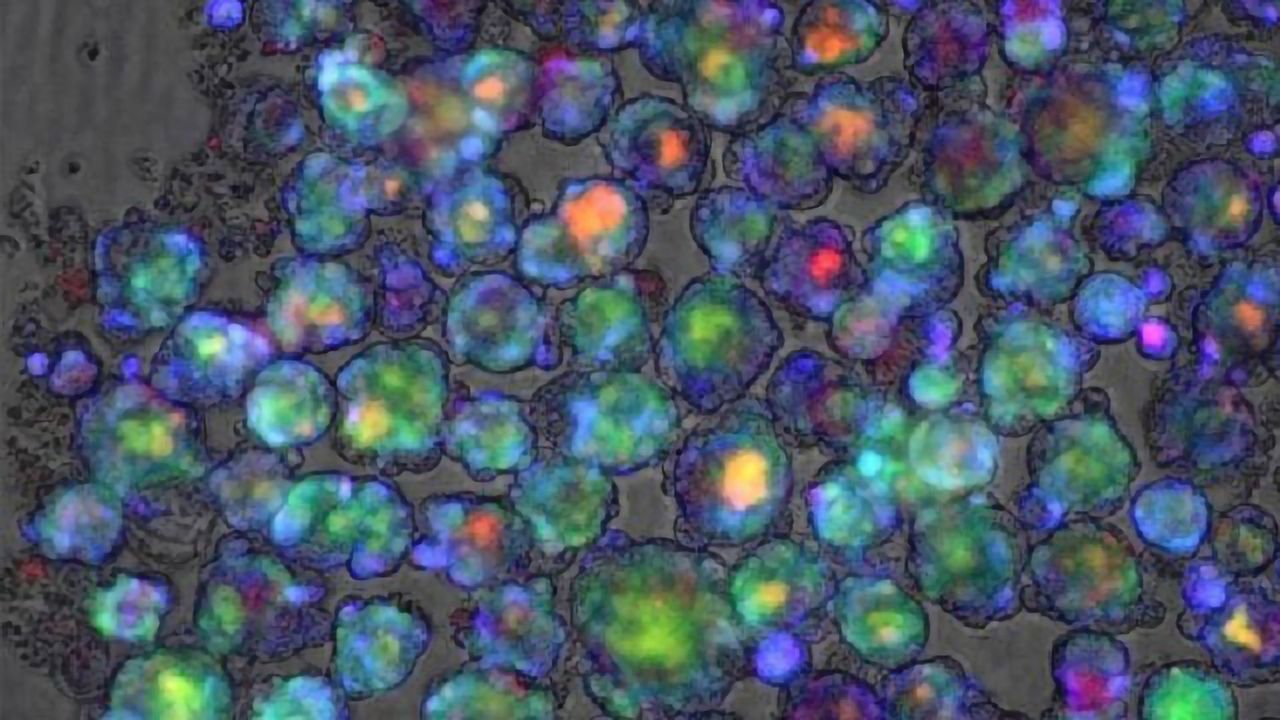 Genetic Test Predicts Risk of Drugs Causing Liver Injury