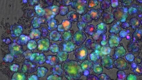 Genetic Test Predicts Risk of Drugs Causing Liver Injury