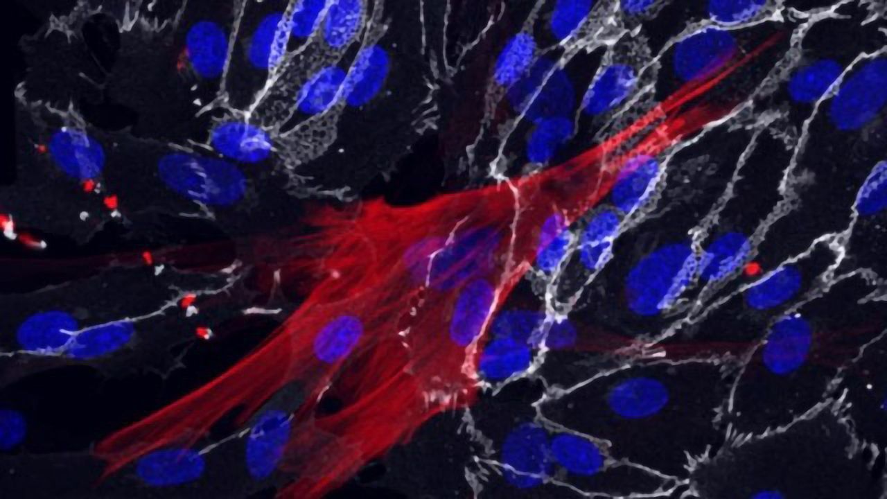Method To Derive Blood Vessel Cells From Skin Cells Suggests Ways To Slow Aging