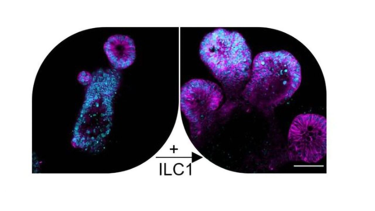 Rare Immune Cells Drive Gut Repair... But at a Cost