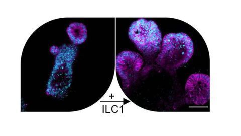 Rare Immune Cells Drive Gut Repair... But at a Cost