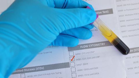 Aigenpulse Launches Data Analysis Suite To Automate Flow Cytometry