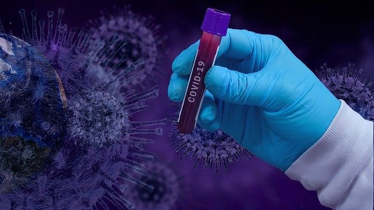 Multi-Organ Effect of COVID-19 Revealed in Metabolite Analysis
