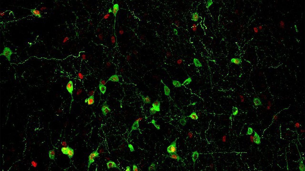 The Neural Circuit That Links Stress, Sleep and Immunity