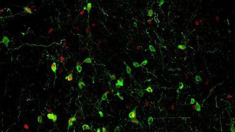 The Neural Circuit That Links Stress, Sleep and Immunity