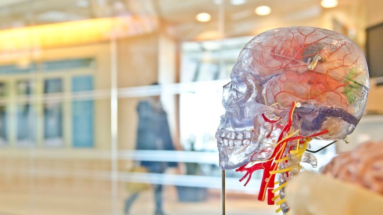 Lumpy Proteins Stiffen the Brain's Blood Vessels