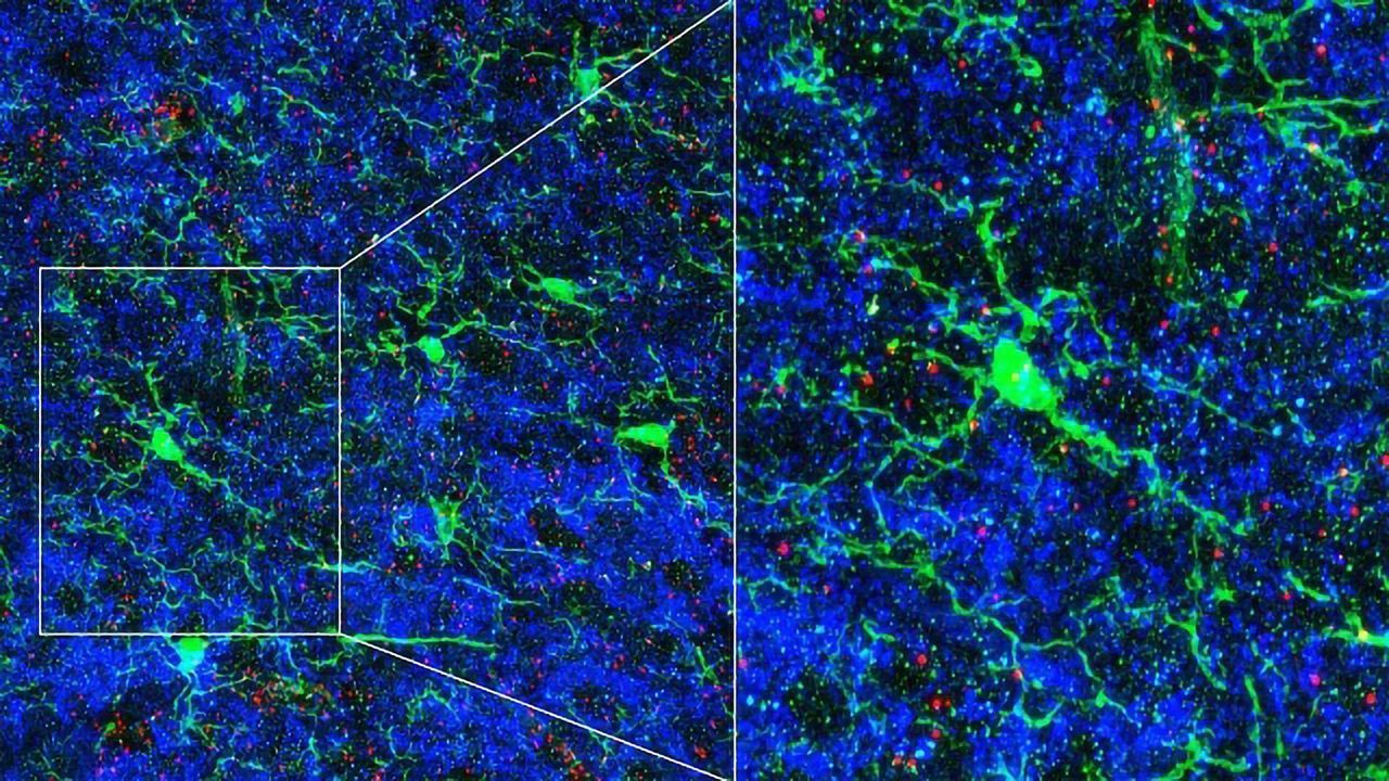 The Brain's Resident Immune Cells Help Sculpt Neural Circuits