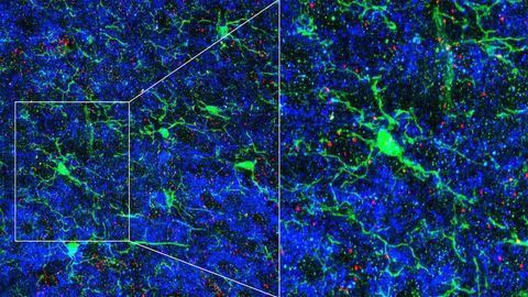 The Brain's Resident Immune Cells Help Sculpt Neural Circuits