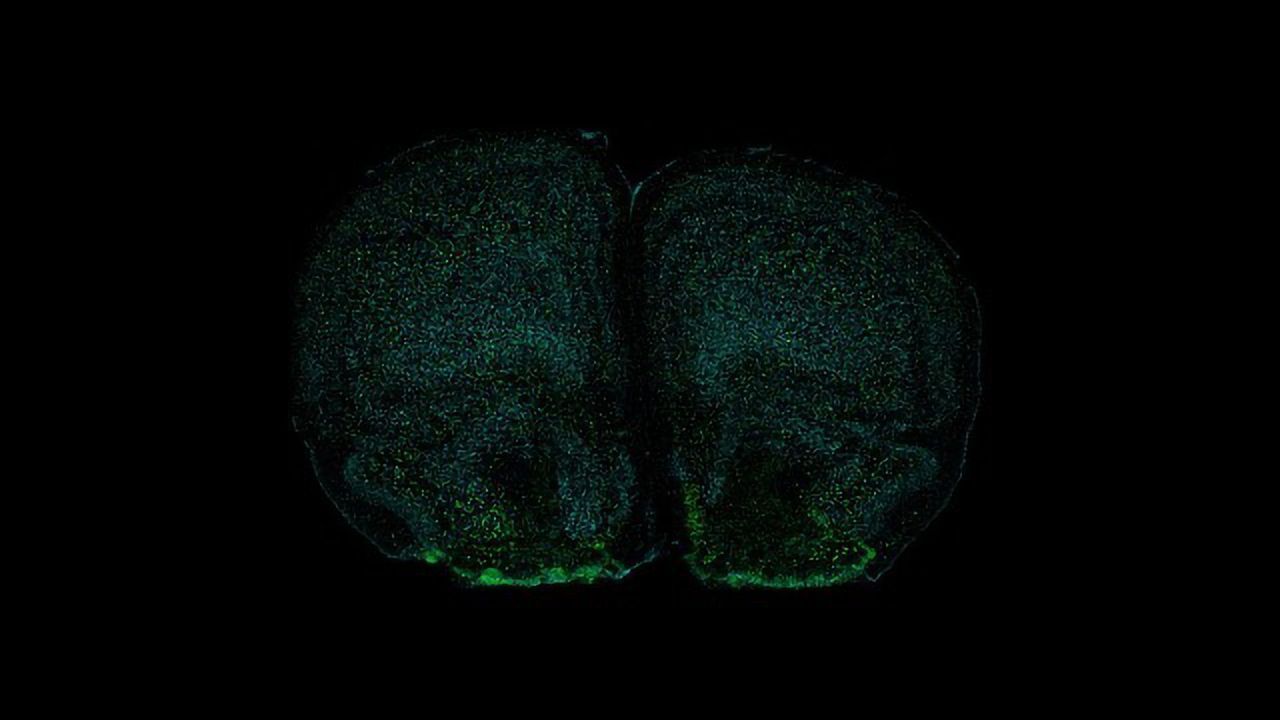Could Our Immune System Alter Behavior?