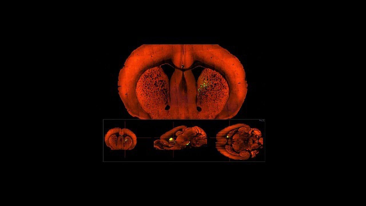 Punishment and Reward Take Similar Paths in the Mouse Brain