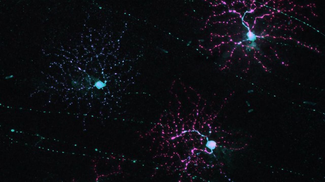 How Does Our Brain Keep Our Visual Field Free of Signal Noise?