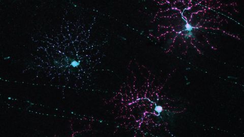 How Does Our Brain Keep Our Visual Field Free of Signal Noise?