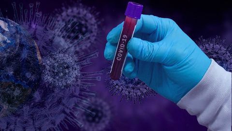 Genomics Union Tracks Strains of SARS-CoV-2