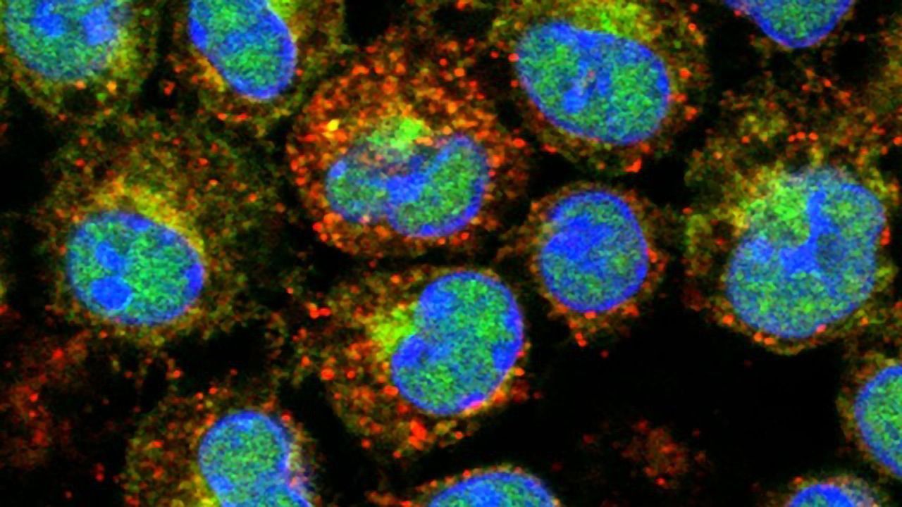 How the Hormones You're Born With Influence Disease Risk