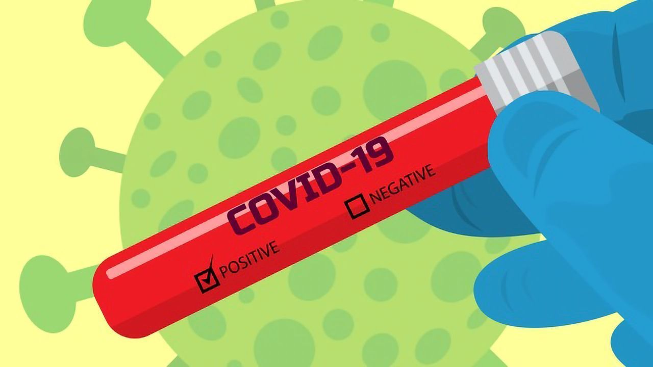 LAMP-Based Testing for COVID-19