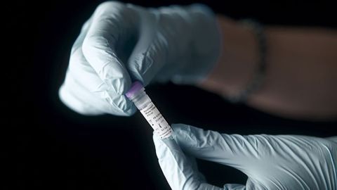 PCR Biosystems Launches RiboShield™ RNase Inhibitor