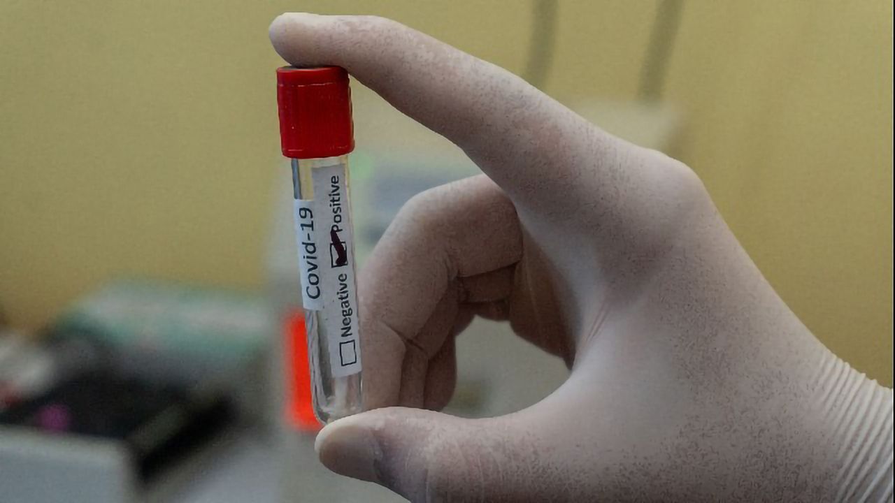 Study of Over 1 Million People Suggests Blood Type O May Protect Against COVID-19
