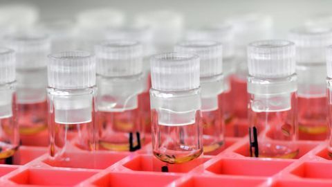 Targeted Proteomics Quantitative Workflows: Considerations for Success