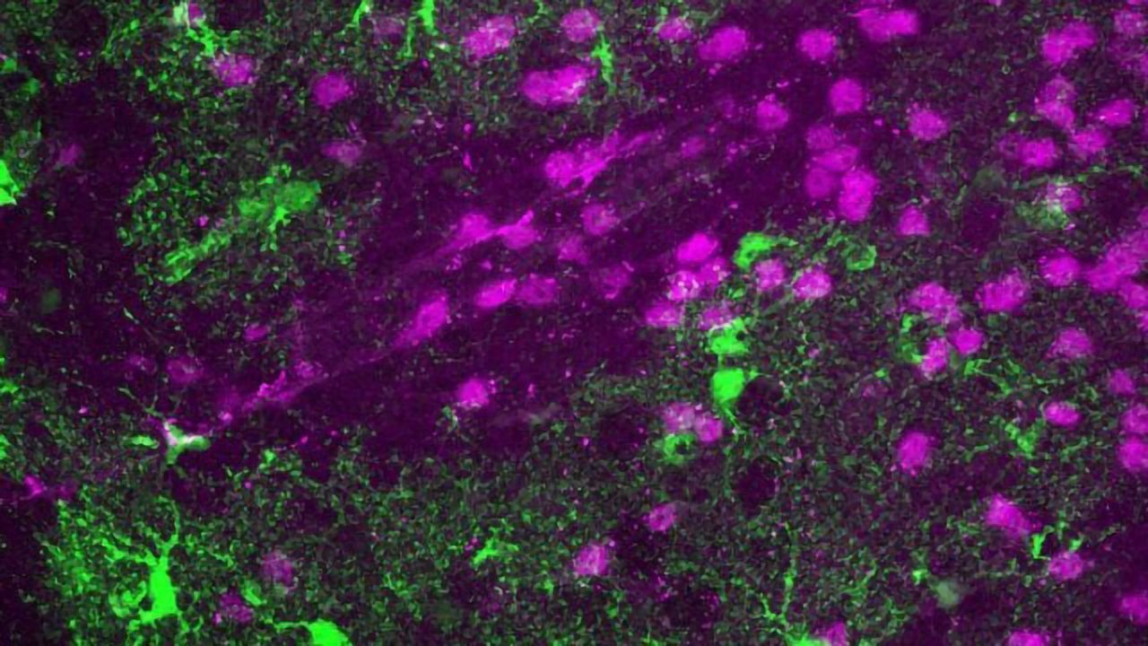 Astrocytes Keep the Brain's "Internal Shield" Healthy