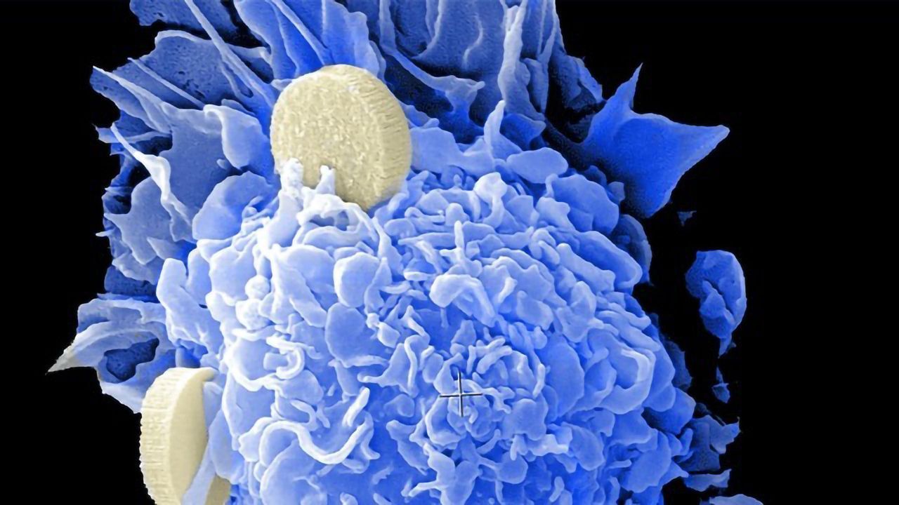 Team Identifies a Driver of Cancer Drug Resistance