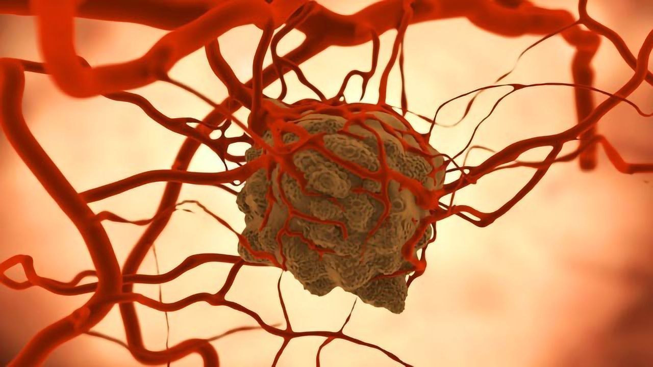 System Developed To Predict Tumor Response to Different Treatments