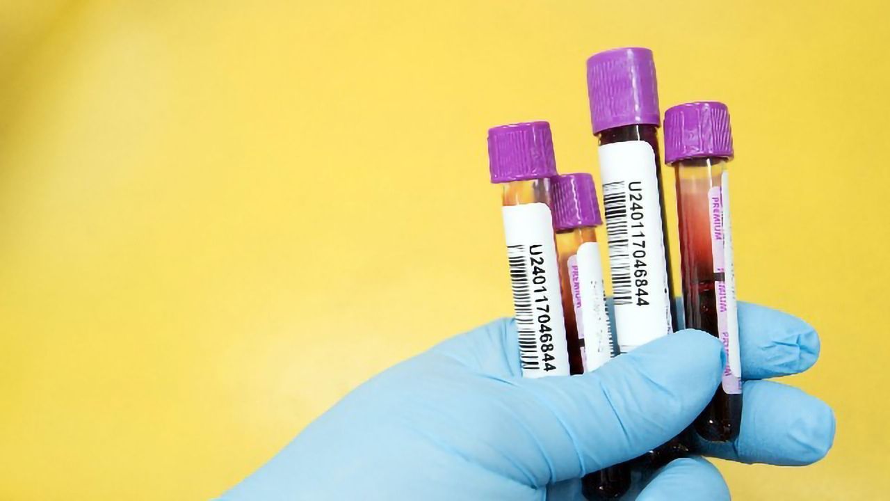 Routine Blood Test Predicts Increased Mortality Risk in Patients With COVID-19