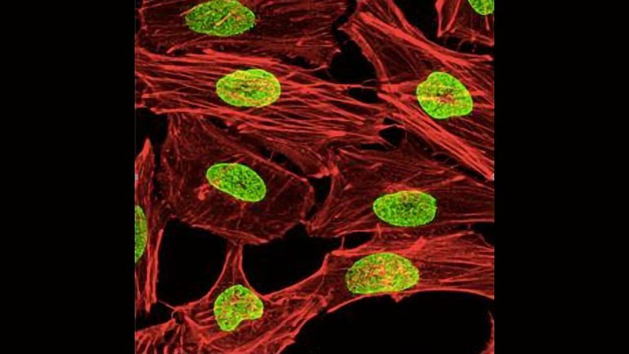 Killing Cancer Cells by Blocking Access to the Nucleus