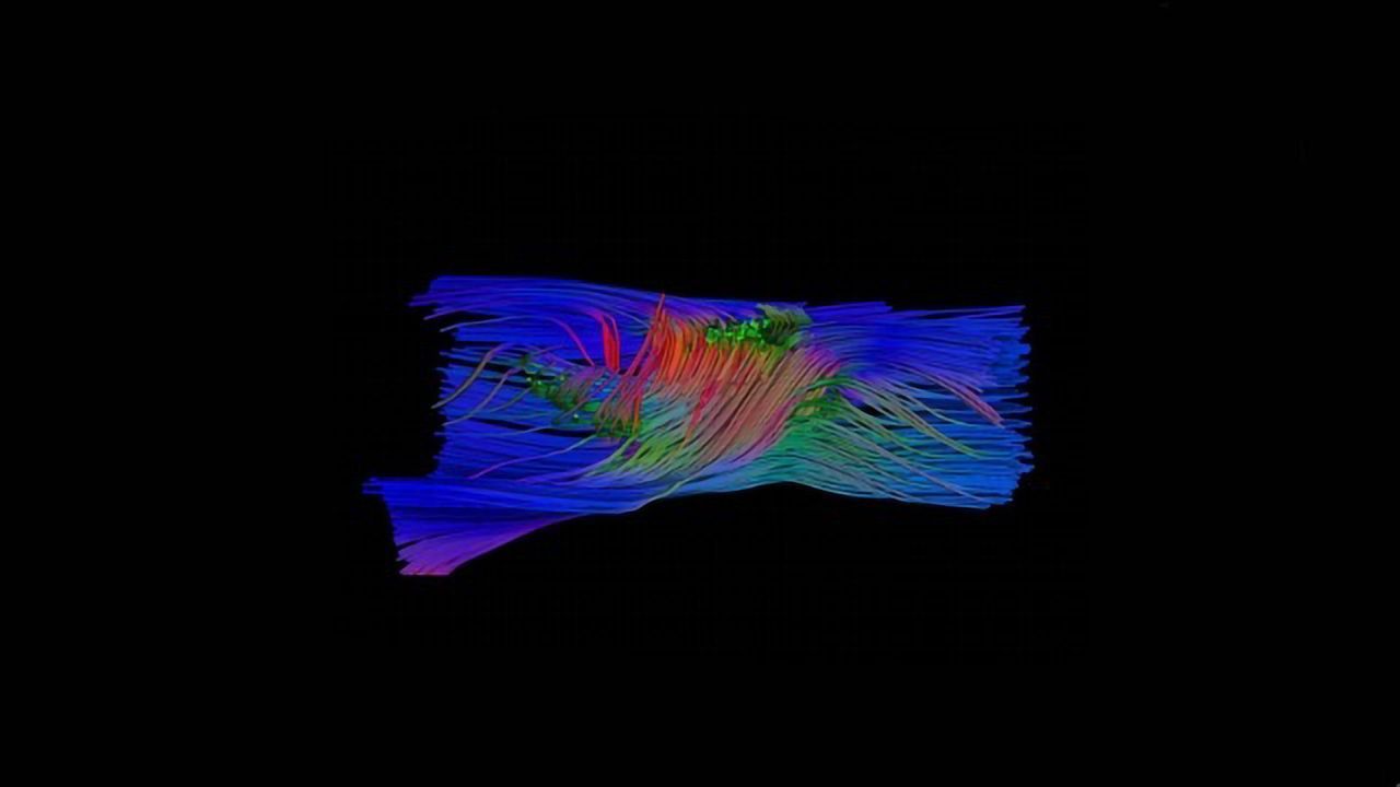 Carbon Nanotube Implants Used to Repair the Mammalian Spinal Cord