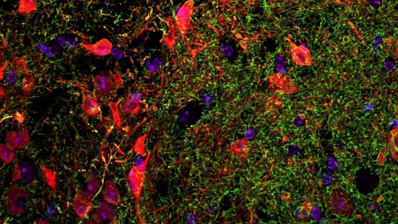 Researchers Revise the Map of Working Memory in the Brain