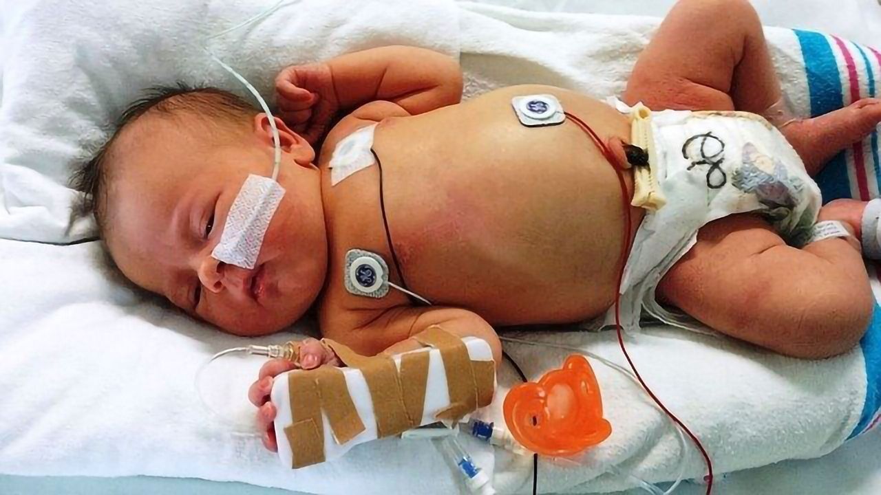 Bacterium Linked to Deadly Childhood Condition