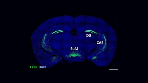 Social Novelty Has a Special Place in the Brain