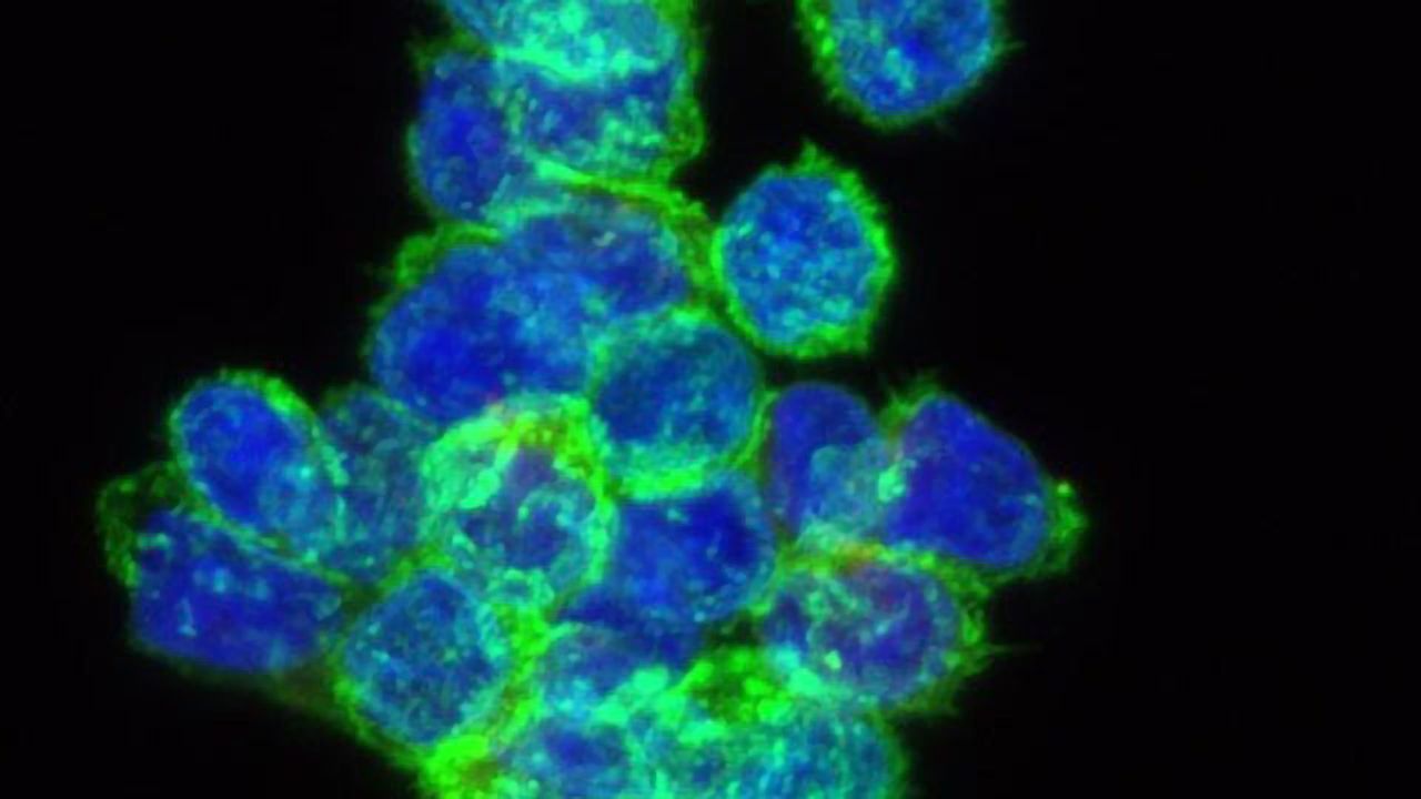 FDA Grants Fast Track Designation to “Switchable” CAR T-Cell Therapy