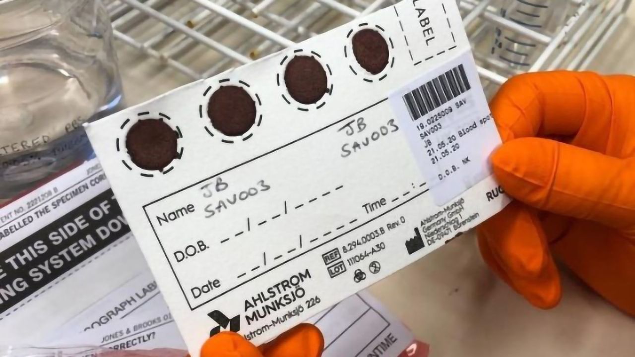 Dried Blood Spot Sampling Offers an Inexpensive Way To Widen Access to Antibody Testing for COVID-19