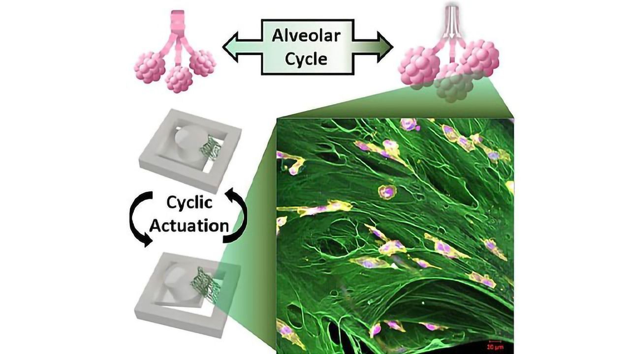 New Platform Tests How Breast Cancer Cells Respond to Stretching