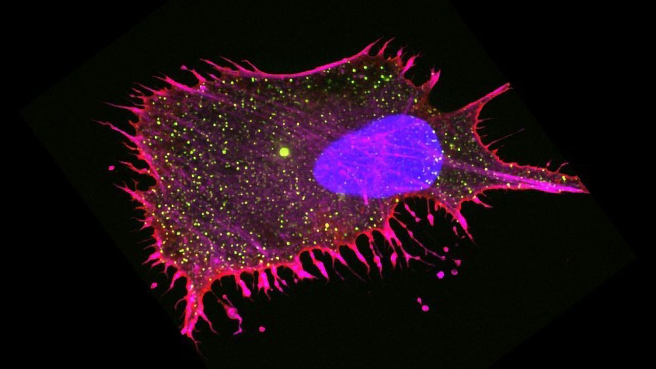 Could Overcrowded Cells Kickstart Neurodegeneration?