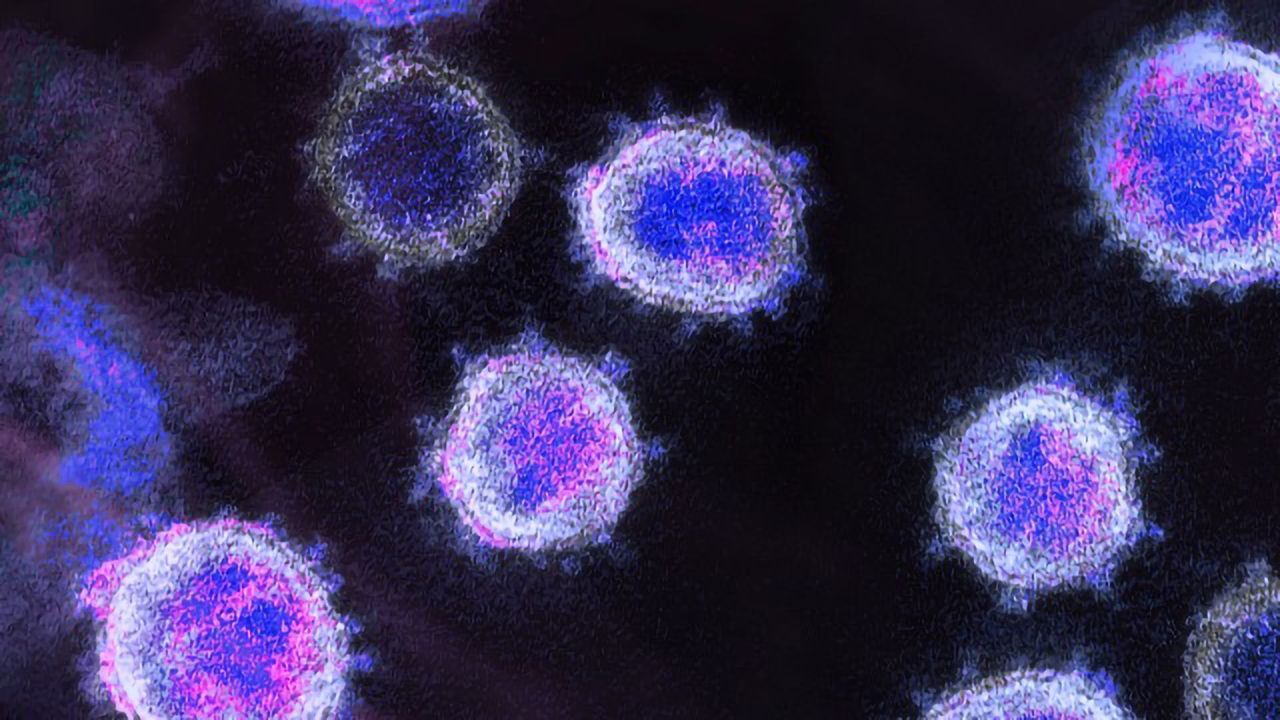 Overactive Immune Cells Linked to Severe COVID-19