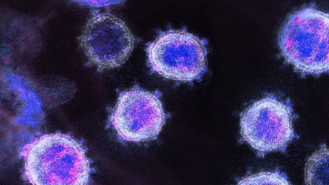 Overactive Immune Cells Linked to Severe COVID-19