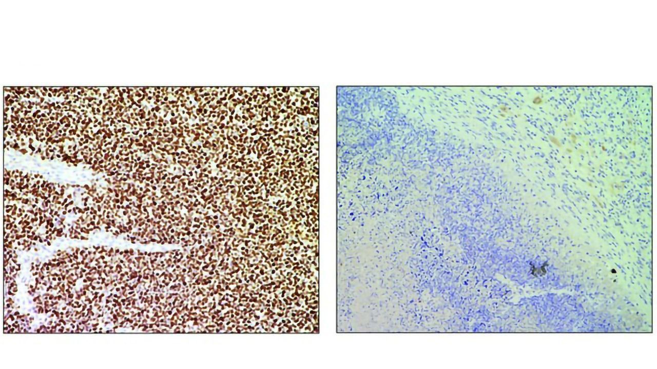 Reprogramming the CRISPR System in Mice To Eliminate Tumor Cells