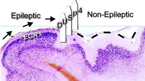 Protein Target Could Help Prevent Epileptic Activity in the Brain