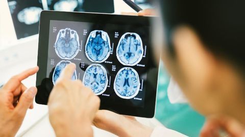 New Tool Accelerates Analysis of MRI Images