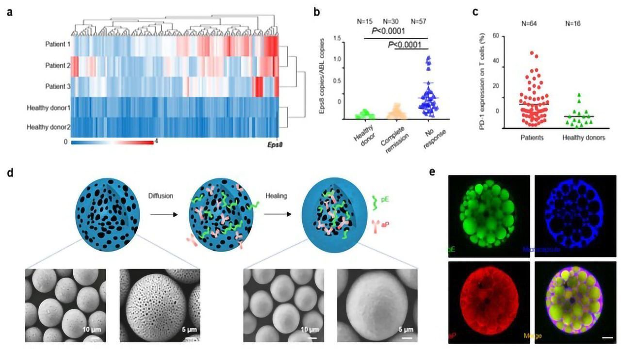 Novel Therapeutic Vaccine Against Leukemia Developed