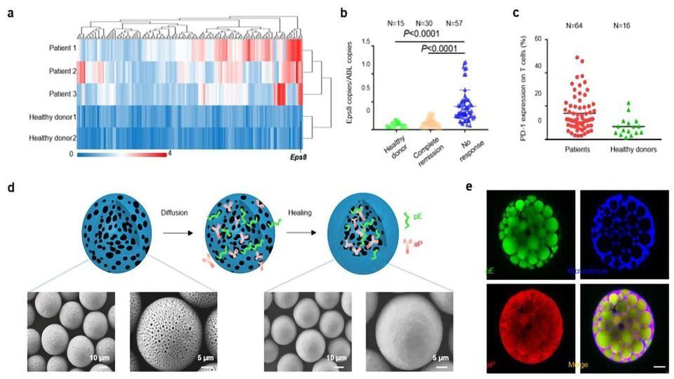 Novel Therapeutic Vaccine Against Leukemia Developed content piece image