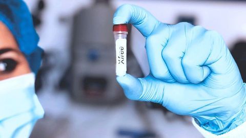 BioGX Submits Direct RT-PCR COVID-19 Test for FDA