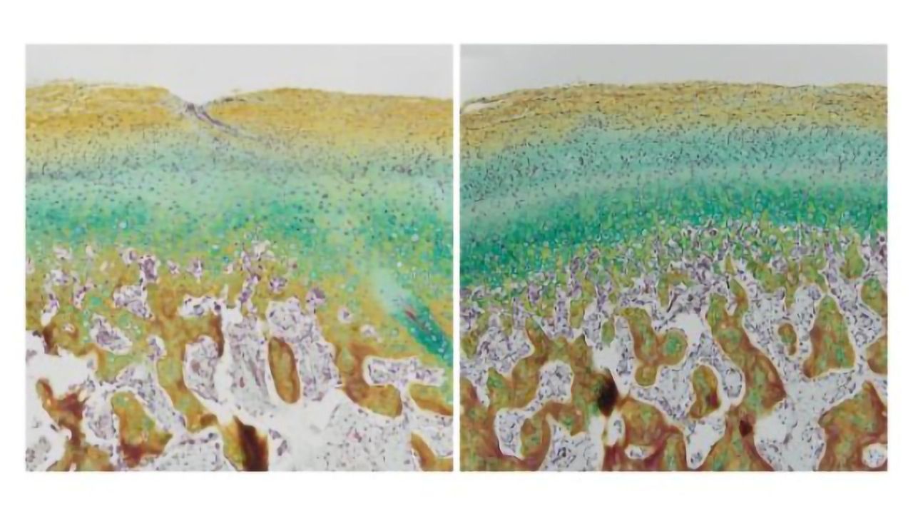 Researchers Use Lab-Grown Tissue Grafts for Personalized Joint Replacement