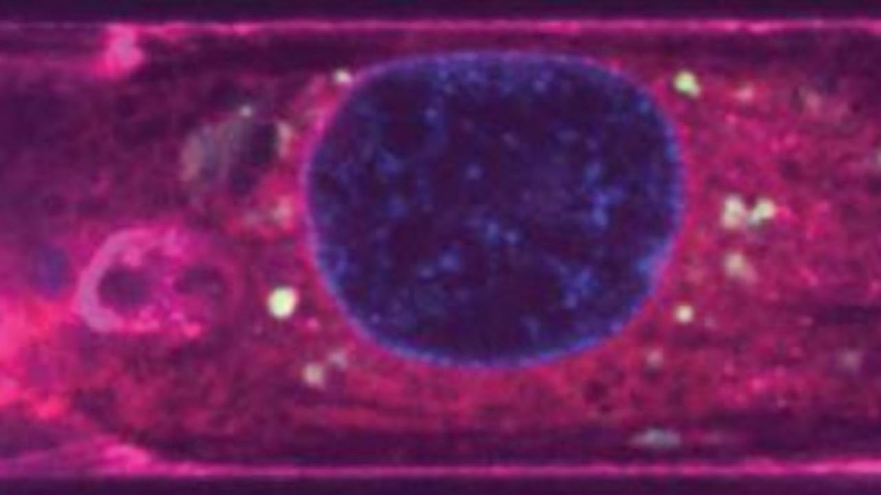 Heart-on-a-Chip Gives Insights Into Cardioprotective Effects of Extracellular Vesicles