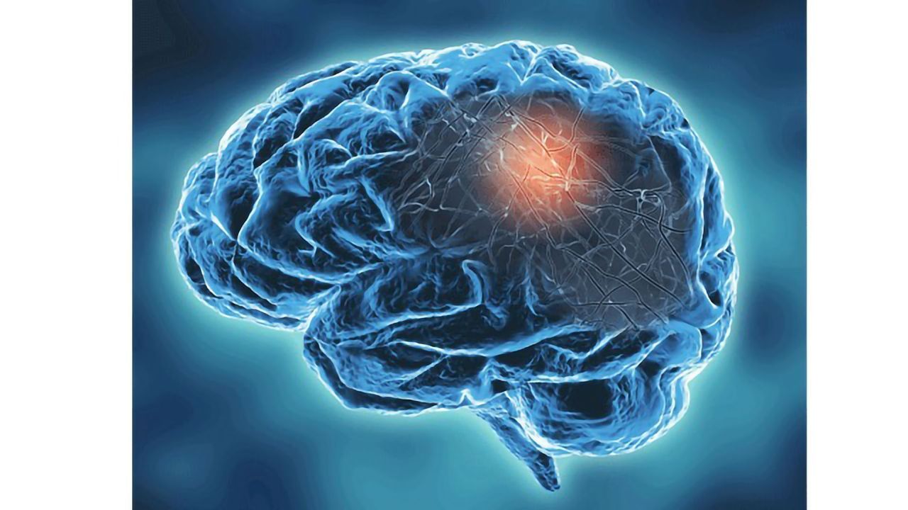 Breakthrough Blood Test Developed for Brain Tumors