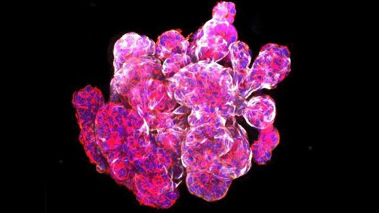 Possible Breast Cancer Treatment for Patients With Specific Gene Mutations