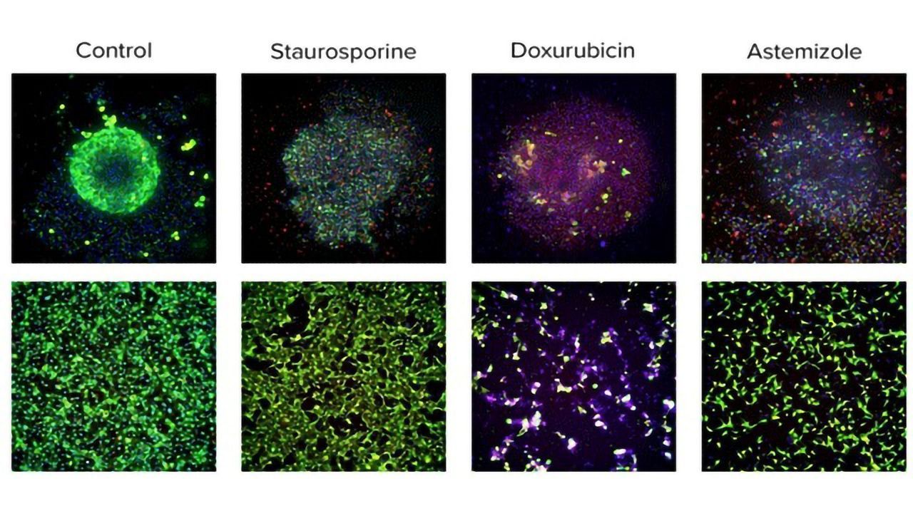 Advanced Cell Screening and Imaging Reveals How the Cardiac System Responds in Drug Development